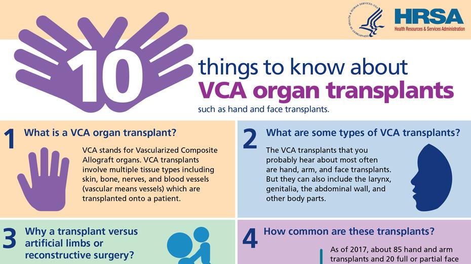 información importante sobre los trasplantes de órganos VCA