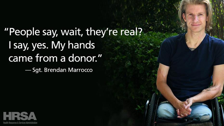 People say, wait, they are real? I say, yes, My hands came from a donor.